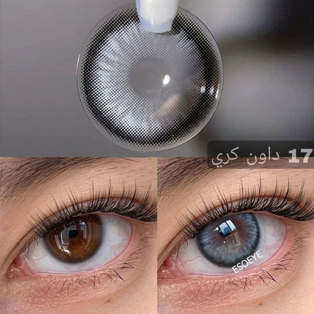 17 داون كري