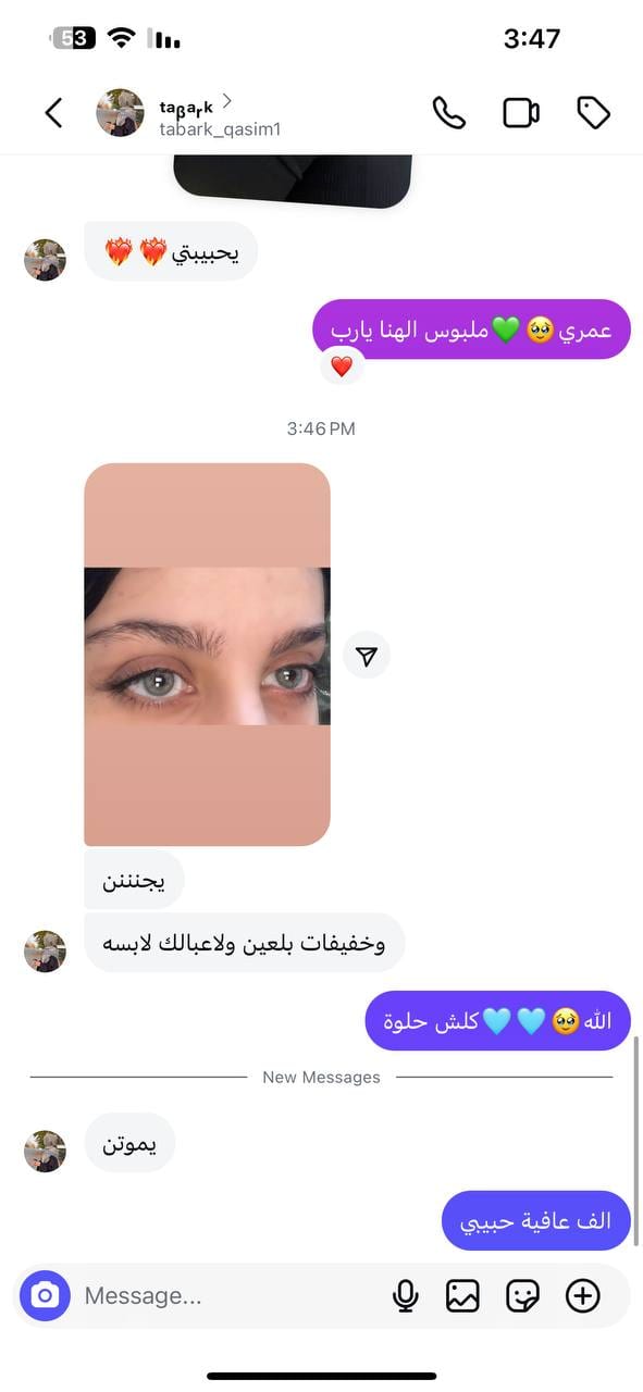 تجربة زبون